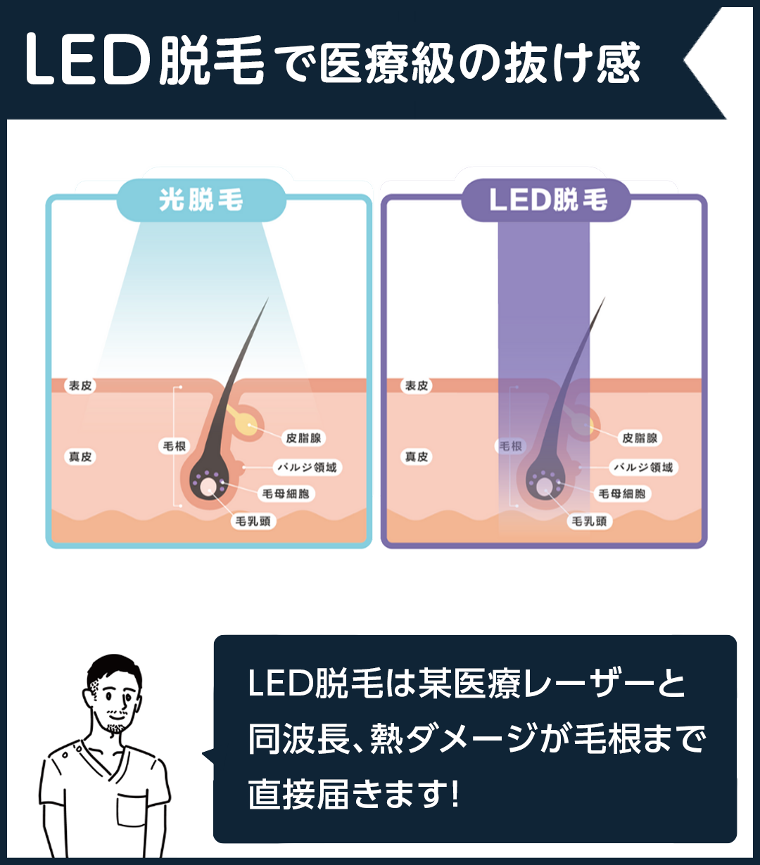 LED脱毛とは？説明画像